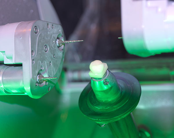 Herstellung eins Zahns