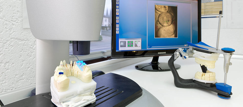 Nahaufnahme des zahntechnischen Labors und Gipsgebiss